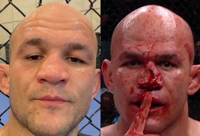 Junior Cigano termina nariz dilacerado após vitória no MMA sem