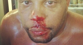 Cormier pega pesado em treino e exibe nariz sangrando: ‘Estou ficando pronto’