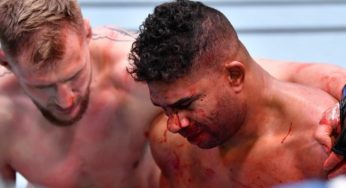 Massacrado no UFC Las Vegas 18, Overeem revela nariz quebrado e descarta aposentadoria imediata