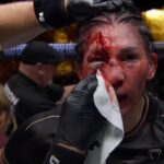 Irene Aldana tem corte brutal sobre Norma Dumont no UFC 306. Foto: Reprodução/UFC News