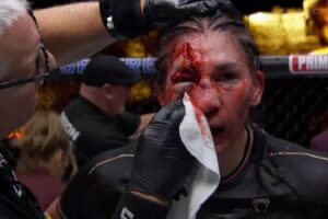 Irene Aldana tem corte brutal sobre Norma Dumont no UFC 306. Foto: Reprodução/UFC News