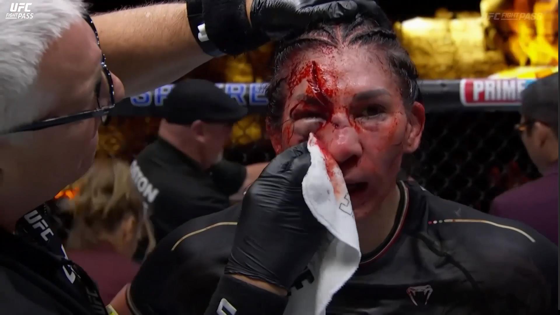 Irene Aldana tem corte brutal sobre Norma Dumont no UFC 306. Foto: Reprodução/UFC News