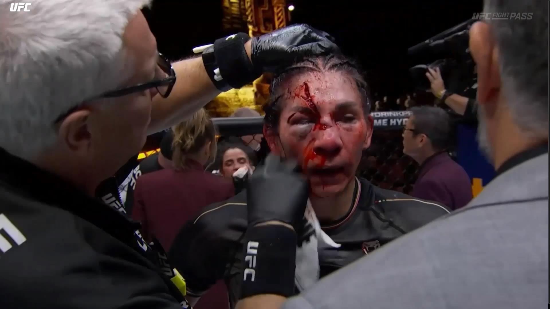 Irene Aldana tem corte brutal sobre Norma Dumont no UFC 306. Foto: Reprodução/UFC News