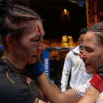 Irene Aldana tem corte brutal sobre Norma Dumont no UFC 306. Foto: Reprodução/UFC News