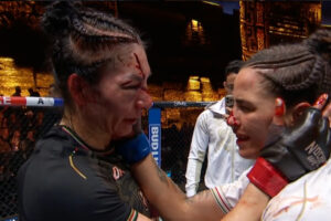 Irene Aldana tem corte brutal sobre Norma Dumont no UFC 306. Foto: Reprodução/UFC News