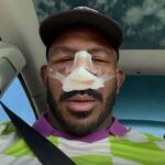 Rountree teve que passar por uma cirurgia no nariz depois que enfrentou Poatan no UFC 307 / Reprodução Instagram