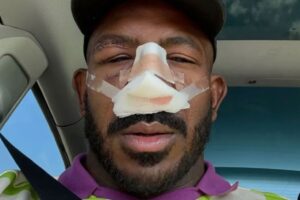 Rountree teve que passar por uma cirurgia no nariz depois que enfrentou Poatan no UFC 307 / Reprodução Instagram