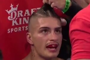 Lutador recorre a corte de cabelo no meio da luta para salvar vitória no boxe. Foto: Reprodução/Twitter/X