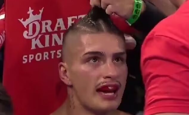 Lutador recorre a corte de cabelo no meio da luta para salvar vitória no boxe. Foto: Reprodução/Twitter/X